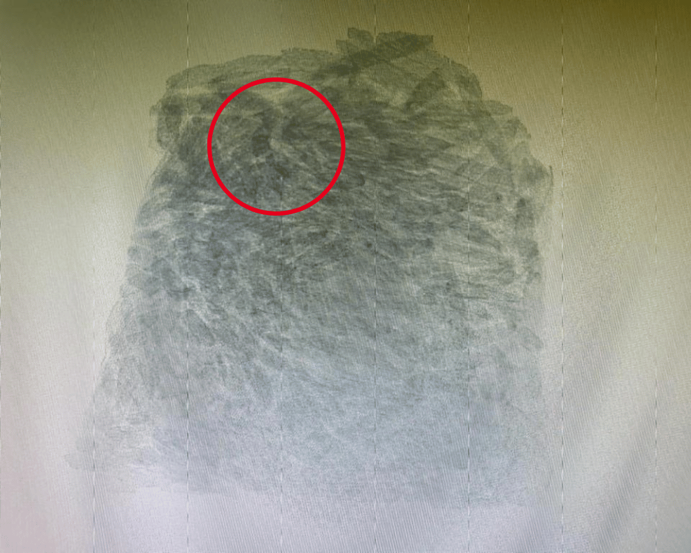 food xray sample 1
