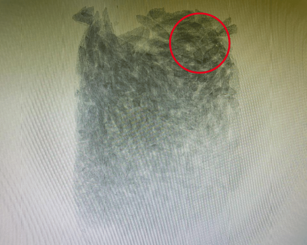 food xray sample 3